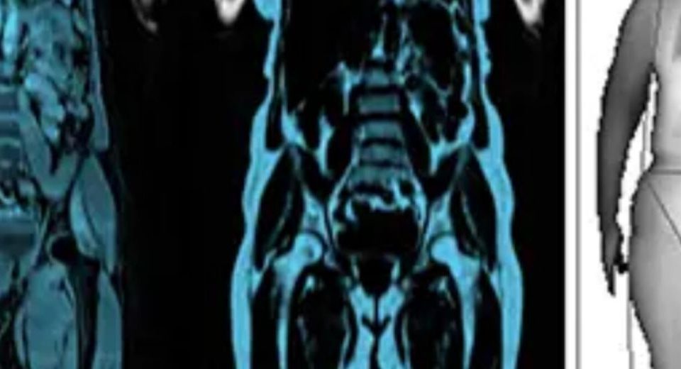 سیستم بازرسی تمام بدن با اشعه ایکس