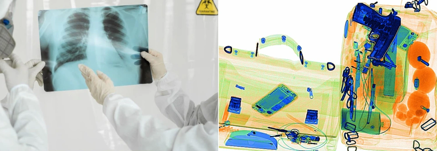 تفاوت دستگاه ایکس ری فرودگاهی با ایکس ری بیمارستانی